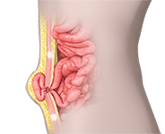 Abdominal wall